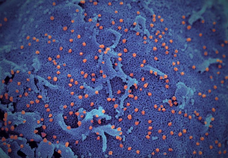 經過培育後, 大量病毒 (橙色) 附於細胞表面 (藍色). 照片由港大醫學院提供